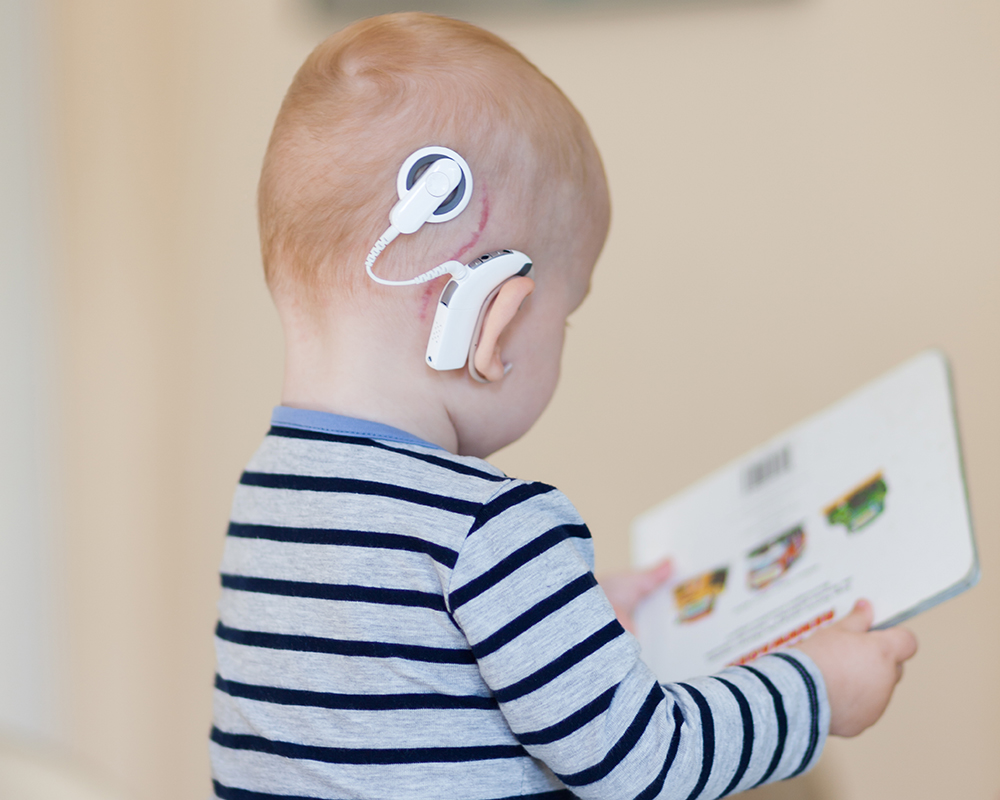 CI_Implantat_Kossmann_UMMD CI_Implantat_Kossmann_UMMD